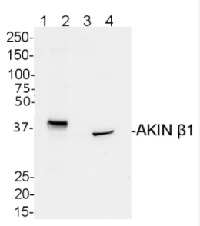 AKINB1 | SNF1-related protein kinase regulatory subunit beta-1 in the group Antibodies for Plant/Algal  / Developmental Biology / Signal transduction at Agrisera AB (Antibodies for research) (AS09 460)